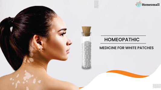 Homeopathic Medicine for White Patches Internally Treats the Problem