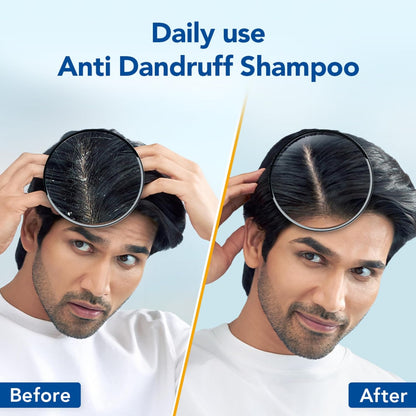 Scalpe Pro Daily Anti-Dandruff Shampoo or Women & Men, 200 Ml